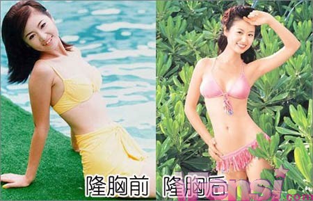 林心如