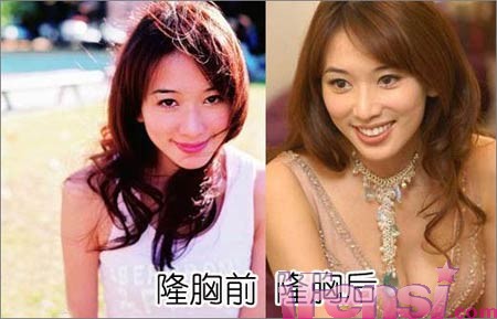 林志玲